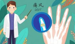 【欽二醫(yī)生說】健康管理專家為您解答高尿酸血癥的幾個(gè)常見誤區(qū)